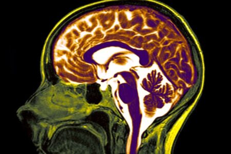 Neuroplastic Fantastic – Modification of Mind