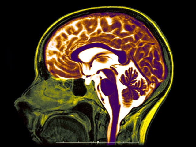 Neuroplastic Fantastic – Modification of Mind